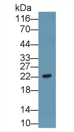 Western Blot; Sample: Recombinant protein.