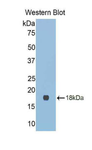 Western Blot; Sample: Recombinant protein.