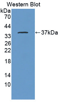 Western Blot; Sample: Recombinant protein.
