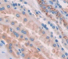 Hyaluronoglucosaminidase 1 (HYAL1) Polyclonal Antibody