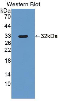 Western Blot; Sample: Recombinant protein.
