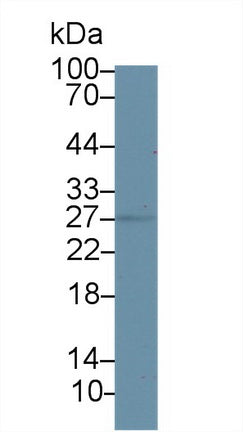 Western Blot; Sample: Mouse Uterus lysate; Primary Ab: 2µg/ml Rabbit Anti-Mouse HSD17b10 Antibody Second Ab: 0.2µg/mL HRP-Linked Caprine Anti-Rabbit IgG Polyclonal Antibody