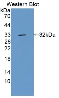 Proprotein Convertase Subtilisin/Kexin Type 9 (PCSK9) Polyclonal Antibody