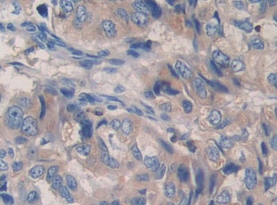 Proprotein Convertase Subtilisin/Kexin Type 9 (PCSK9) Polyclonal Antibody