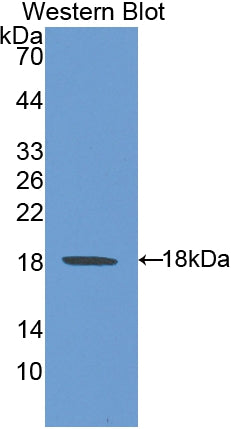 Heat Shock 105kDa/110kDa Protein 1 (HSPH1) Polyclonal Antibody