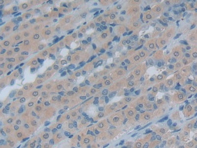 Heat Shock 105kDa/110kDa Protein 1 (HSPH1) Polyclonal Antibody