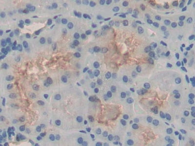 Heat Shock 105kDa/110kDa Protein 1 (HSPH1) Polyclonal Antibody