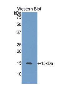 Heat Shock 105kDa/110kDa Protein 1 (HSPH1) Polyclonal Antibody