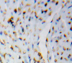 Heat Shock 105kDa/110kDa Protein 1 (HSPH1) Polyclonal Antibody