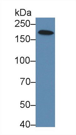Western Blot; Sample: Human MCF7 cell lysate; Primary Ab: 2µg/ml Rabbit Anti-Rat XRN1 Antibody Second Ab: 0.2µg/mL HRP-Linked Caprine Anti-Rabbit IgG Polyclonal Antibody