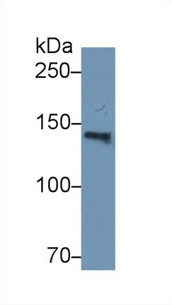Western Blot; Sample: Human Serum; Primary Ab: 2µg/ml Rabbit Anti-Human HYOU1 Antibody Second Ab: 0.2µg/mL HRP-Linked Caprine Anti-Rabbit IgG Polyclonal Antibody