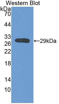 Sodium/potassium Transporting ATPase Subunit Beta-3 (ATP1b3) Polyclonal Antibody