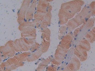 Sodium/potassium Transporting ATPase Subunit Beta-3 (ATP1b3) Polyclonal Antibody