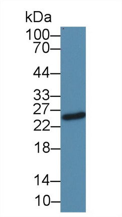 Western Blot; Sample: Human Serum; ;Primary Ab: 500 Mouse Anti-Human IgG1 Antibody;Second Ab: 0.2µg/mL HRP-Linked Caprine Anti-Mouse IgG Polyclonal Antibody;