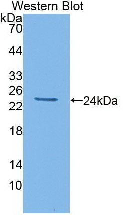 Interleukin 6 (IL6) Monoclonal Antibody, CAU29171