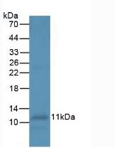 Western Blot; Sample: Human Leukocyte Cells.