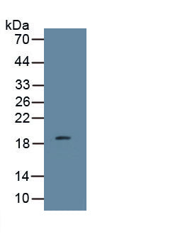 Leptin (LEP) Monoclonal Antibody, CAU29184
