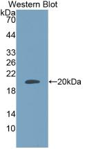 Western Blot;Sample: Recombinant ADM, Human.