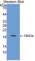 Western Blot;Sample: Recombinant IL1RA, Simian.