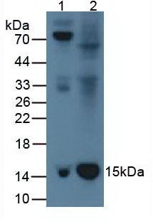 Western Blot Lane1: Rat Serum Tissue Lane2: Rat Spleen Tissue Primary Ab: 1µg/mL Rabbit Anti-Rat b2M Ab Second Ab: 1:5000 Dilution of HRP-Linked Rabbit Anti-Mouse IgG Ab