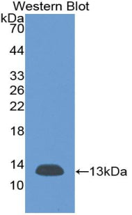 Western Blot;Sample:Recombinant b2M, Rat