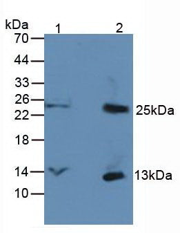 Western Blot Lane1: Rat Brain Tissue Lane2: Rat Liver Tissue Primary Ab: 3µg/mL Rabbit Anti-Human bTG Ab Second Ab: 1:5000 Dilution of HRP-Linked Rabbit Anti-Mouse IgG Ab