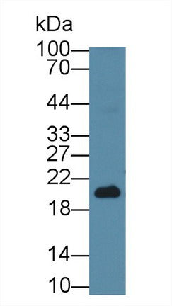 Western Blot; Sample: Porcine Liver lysate; Primary Ab: 5µg/ml Mouse Anti-Human NKA Antibody Second Ab: 0.2µg/mL HRP-Linked Caprine Anti-Mouse IgG Polyclonal Antibody