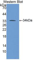 Western Blot;Sample: Recombinant ALOX5, Human.
