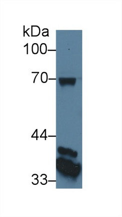 CUB And Zona Pellucida Like Domains Protein 1 (CUZD1) Monoclonal Antibody, CAU30333