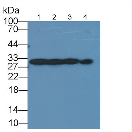 Galectin 3 (GAL3) Monoclonal Antibody, CAU30617