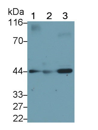 Sex Hormone Binding Globulin (SHBG) Monoclonal Antibody, CAU30625
