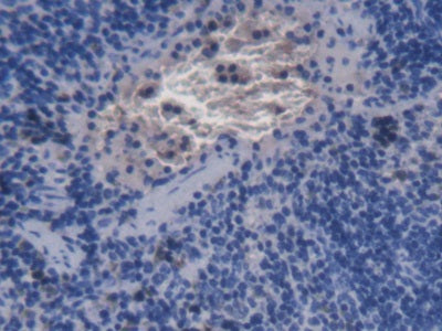 DAB staining on IHC-P; Samples: Mouse Spleen Tissue;  Primary Ab: 20µg/ml Mouse Anti-Mouse aHSP Anti