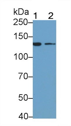 Insulin Receptor (INSR) Monoclonal Antibody, CAU30691