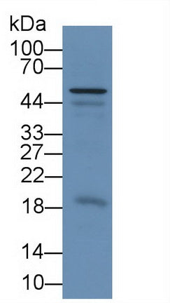 Chemerin (CHEM) Monoclonal Antibody, CAU30695