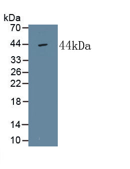 Alkaline Phosphatase, Tissue-nonspecific (ALPL) Monoclonal Antibody, CAU30704