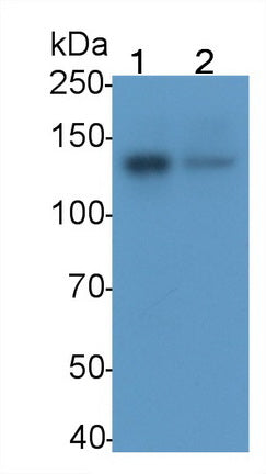 Focal Adhesion Kinase (FAK) Monoclonal Antibody, CAU30719
