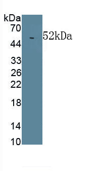Lipopolysaccharide Binding Protein (LBP) Monoclonal Antibody, CAU30726