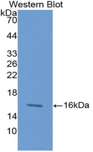 Chemokine (C-X-C Motif) Ligand 27 (CCL27) Monoclonal Antibody, CAU30737