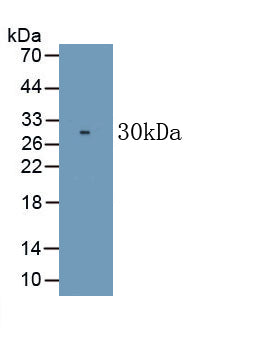 Cluster Of Differentiation 226 (CD226) Monoclonal Antibody, CAU30741