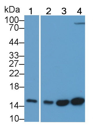 Fatty Acid Binding Protein 4 (FABP4) Monoclonal Antibody, CAU30742