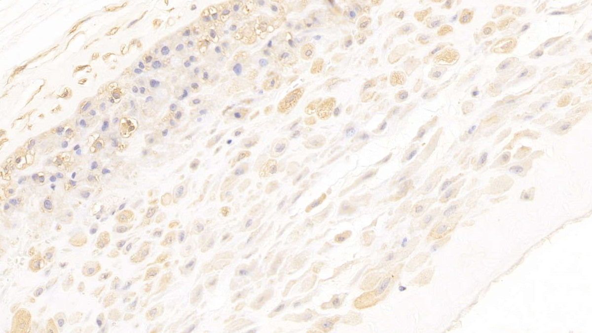 DAB staining on IHC-P; Samples: Human Placenta Tissue; Primary Ab: 10µg/ml Mouse Anti-Human ANXA2 Antibody Second Ab: 2µg/mL HRP-Linked Caprine Anti-Mouse IgG Polyclonal Antibody
