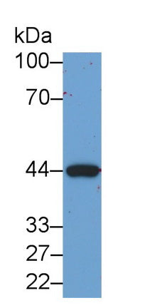 Creatine Kinase B (CK-BB) Monoclonal Antibody, CAU30762