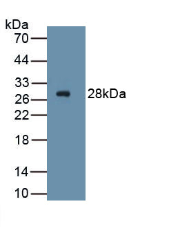 Platelet Derived Growth Factor Receptor Alpha (PDGFRa) Monoclonal Antibody, CAU30766
