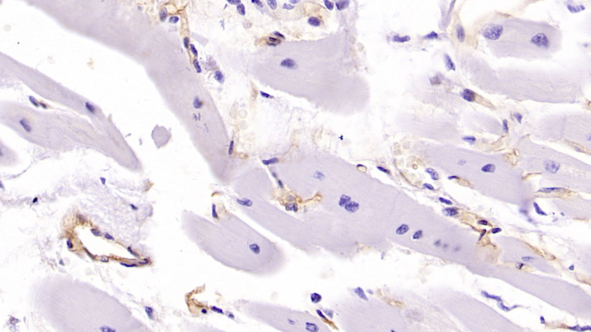 DAB staining on IHC-P; Samples: Human Cardiac Muscle Tissue;  Primary Ab: 40µg/ml Mouse Anti-Human MHCC Antibody Second Ab: 2µg/mL HRP-Linked Caprine Anti-Mouse IgG Polyclonal Antibody 