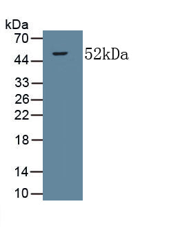 Collagen Type V Alpha 2 (COL5a2) Monoclonal Antibody, CAU30776