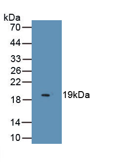 Endothelial Cell Specific Molecule 1 (ESM1) Monoclonal Antibody, CAU30781