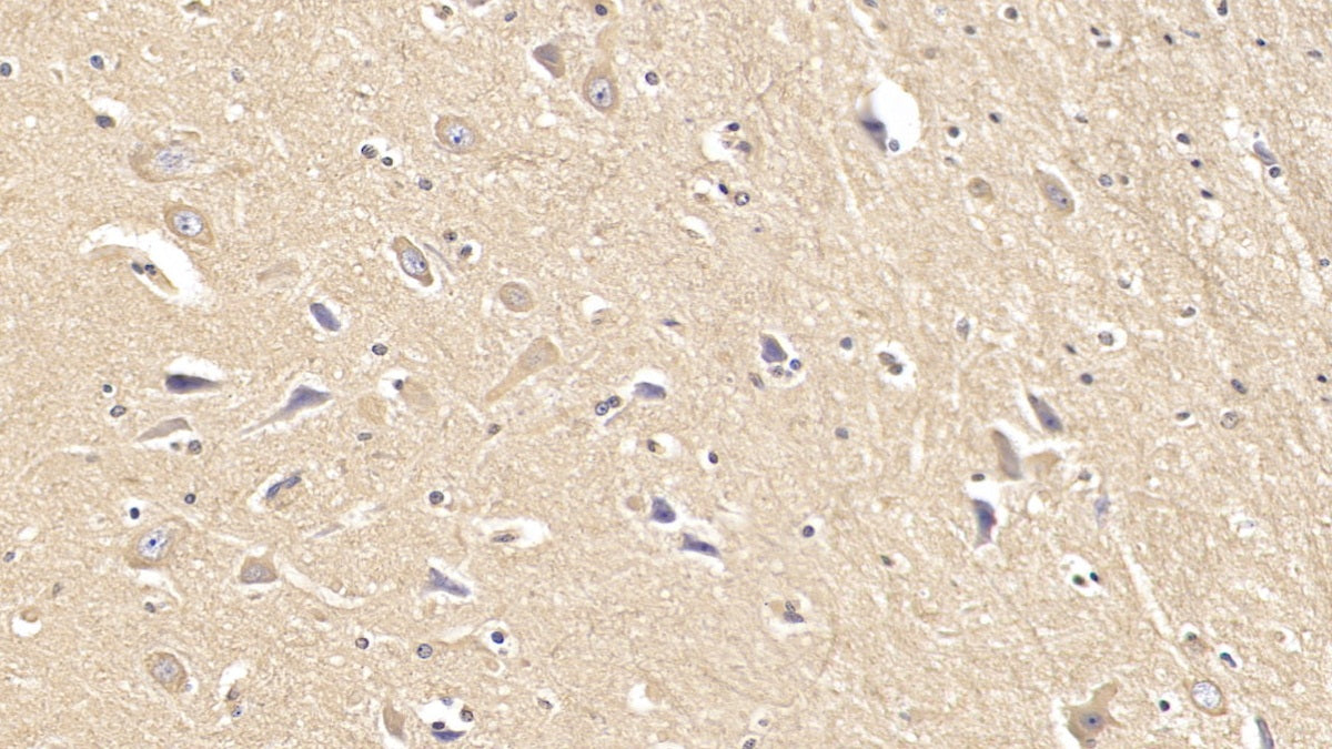 DAB staining on IHC-P; Samples: Human Cerebrum Tissue; Primary Ab: 30µg/ml Mouse Anti-Human FAPa Antibody Second Ab: 2µg/mL HRP-Linked Caprine Anti-Mouse IgG Polyclonal Antibody