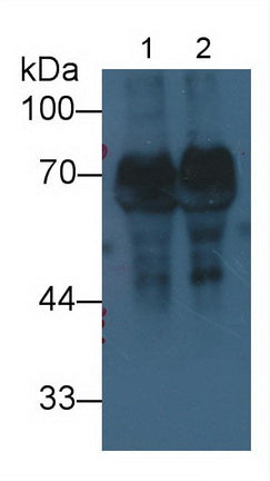 Histidine Rich Glycoprotein (HRG) Monoclonal Antibody, CAU30785