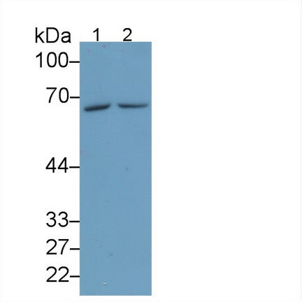 Arginyl tRNA Synthetase (RARS) Monoclonal Antibody, CAU30794