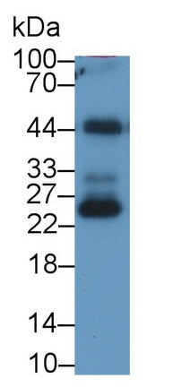 Ferritin, Light Polypeptide (FTL) Monoclonal Antibody, CAU30796